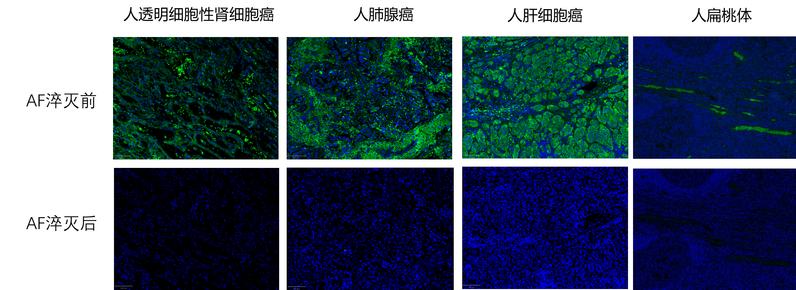 FluoRevo 淬灭组织自发荧光前后对比图 2